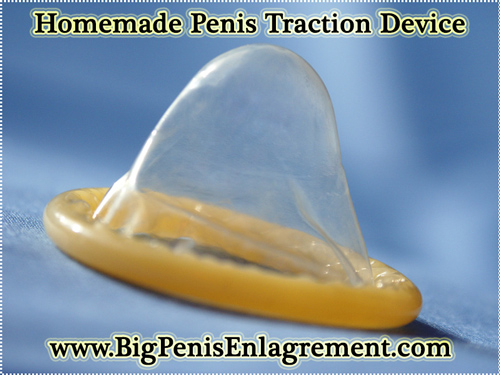 Homemade Penis Traction Device